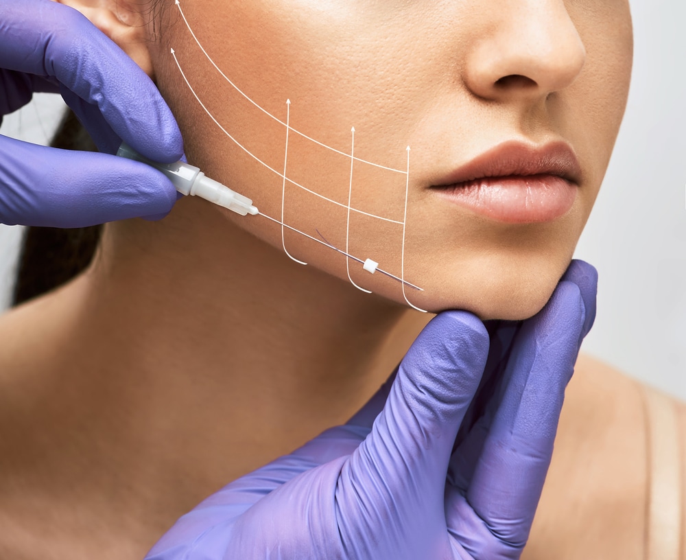 Woman gets a threadlift in the office of her Houston physician